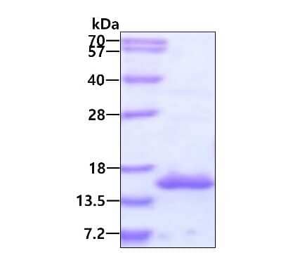 SDS-PAGE: Recombinant Human POLR2J His Protein [NBP2-23347]